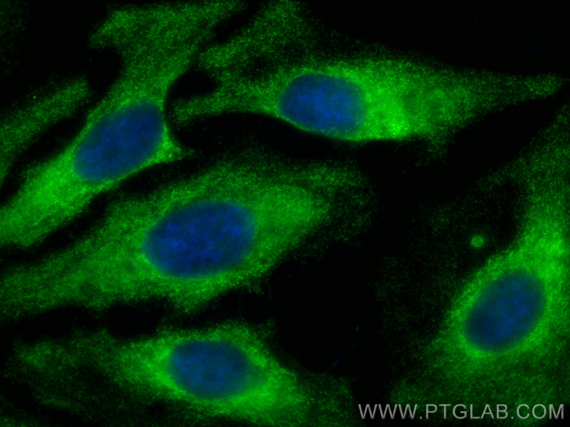 Immunofluorescence (IF) / fluorescent staining of HeLa cells using PTPN14 Monoclonal antibody (67744-1-Ig)