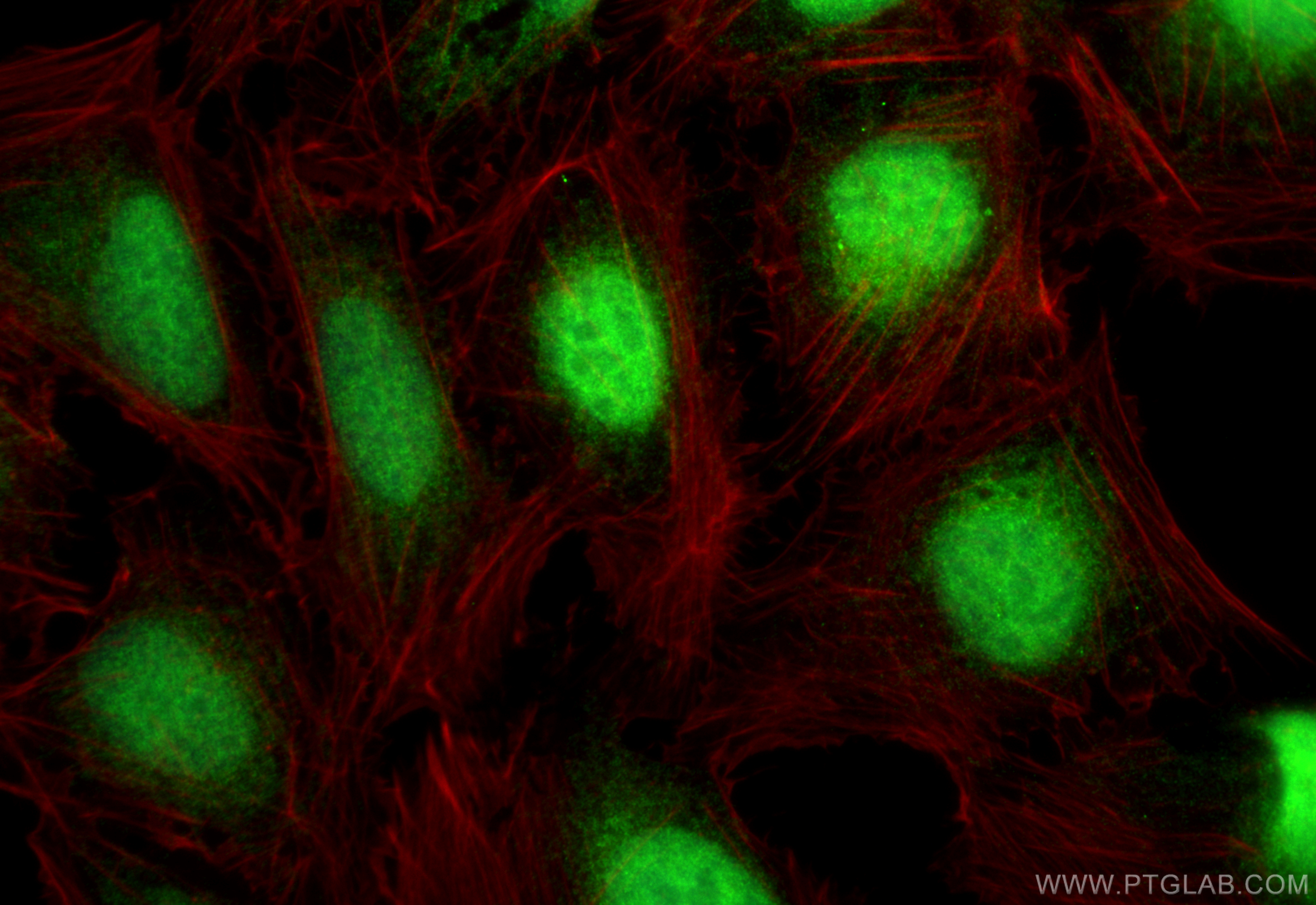 Immunofluorescence (IF) / fluorescent staining of U2OS cells using PTPN2 Polyclonal antibody (11214-1-AP)