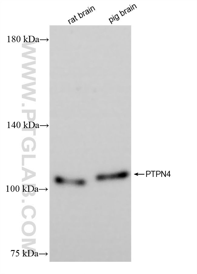 Western Blot (WB) analysis of various lysates using PTPN4 Recombinant antibody (83695-1-RR)