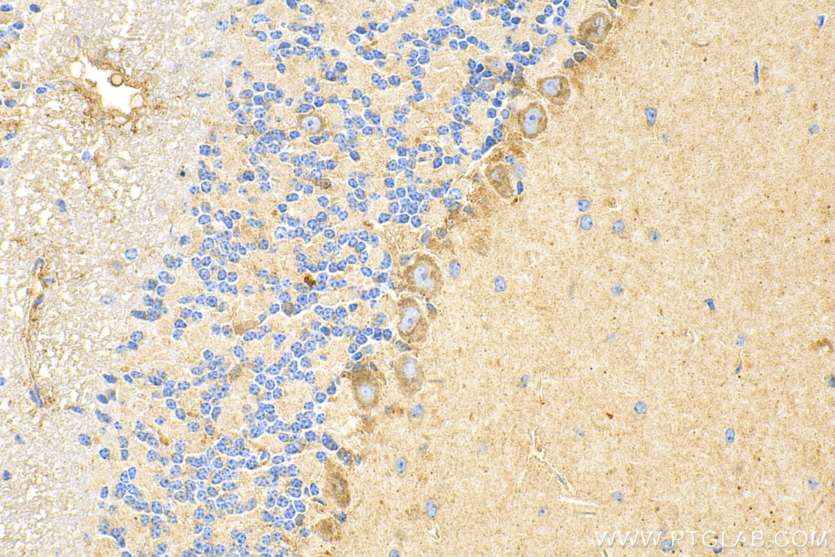 Immunohistochemistry (IHC) staining of mouse cerebellum tissue using PTPRS Polyclonal antibody (31720-1-AP)