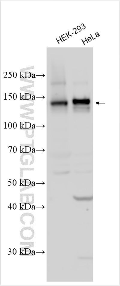 Western Blot (WB) analysis of various lysates using PTPRS Polyclonal antibody (31720-1-AP)