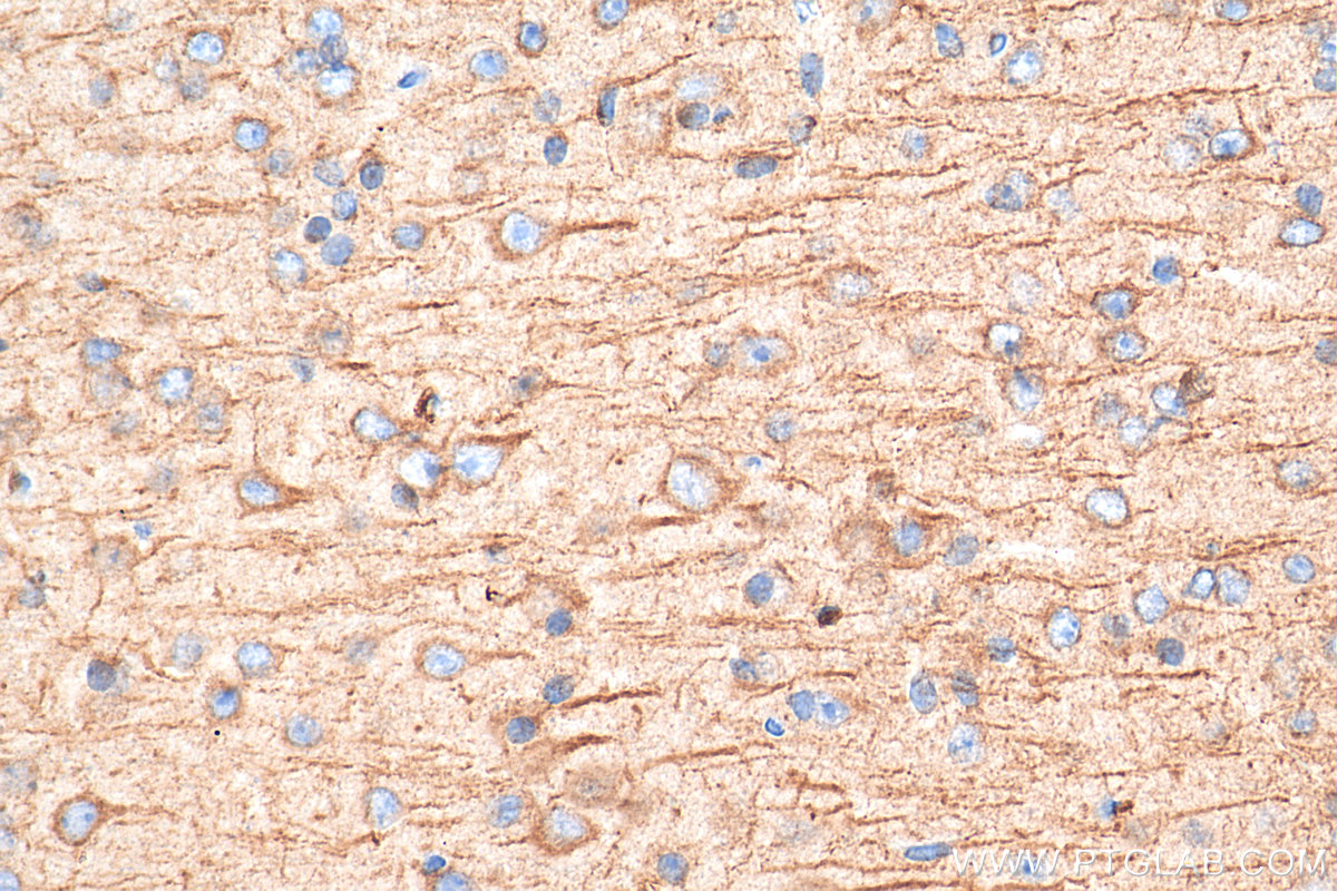 Immunohistochemistry (IHC) staining of mouse brain tissue using PTPRT Polyclonal antibody (25473-1-AP)