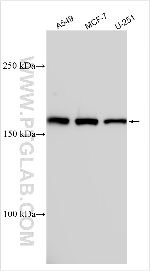 Western Blot (WB) analysis of various lysates using PTPRU Polyclonal antibody (23786-1-AP)
