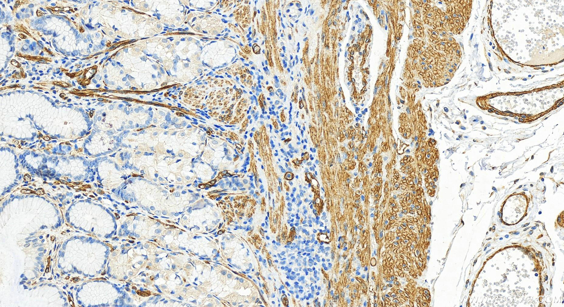 Immunohistochemistry (IHC) staining of human stomach tissue using PTRF Polyclonal antibody (30086-1-AP)