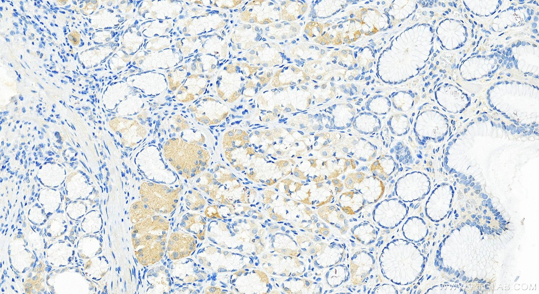 Immunohistochemistry (IHC) staining of human stomach tissue using PTRF Recombinant antibody (82697-1-RR)