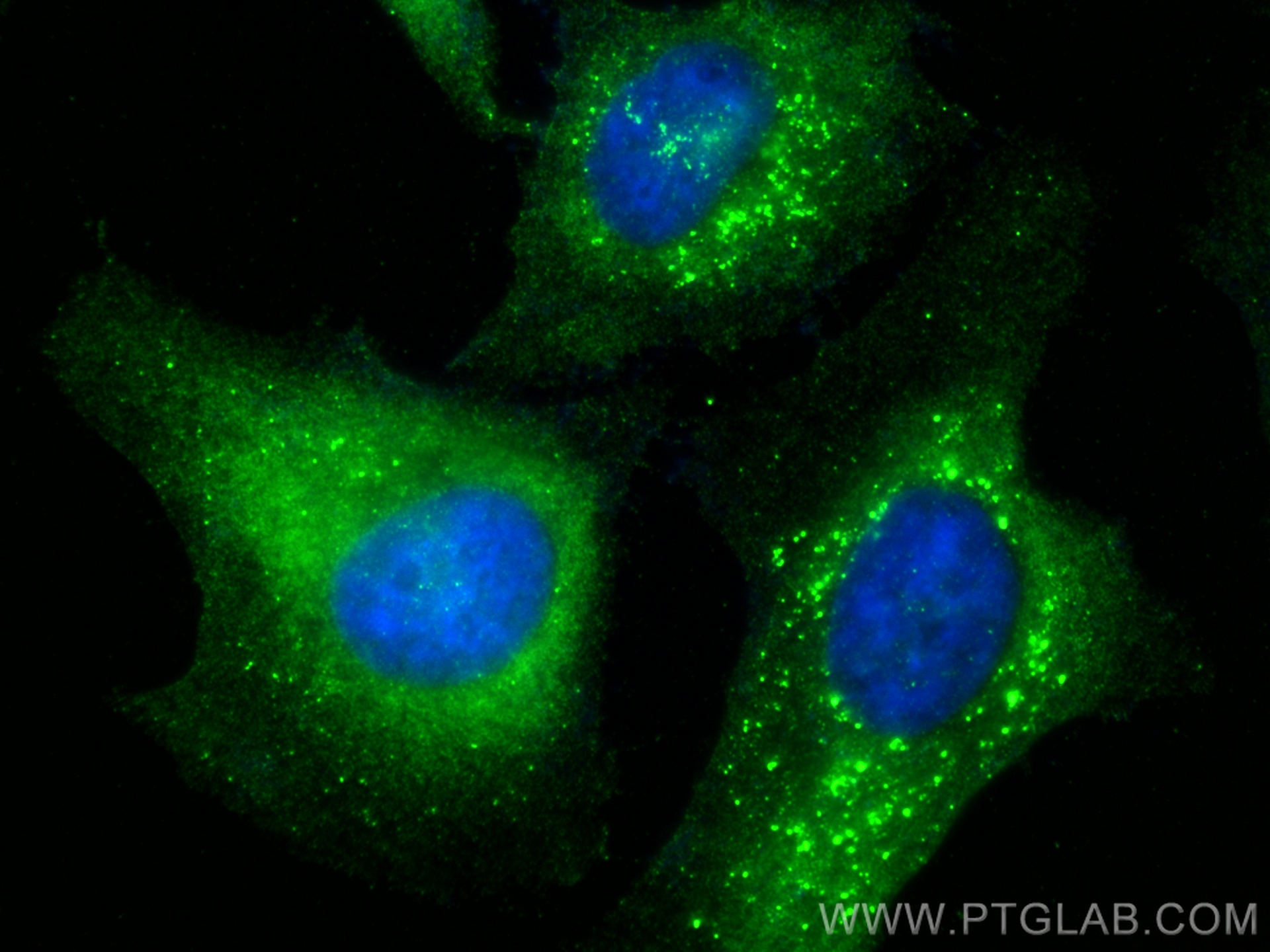 Immunofluorescence (IF) / fluorescent staining of HeLa cells using PTS Polyclonal antibody (12150-1-AP)