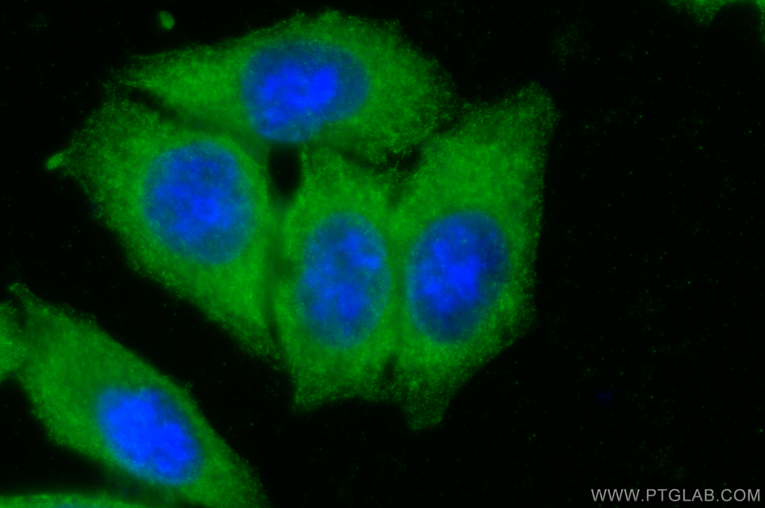 Immunofluorescence (IF) / fluorescent staining of HepG2 cells using Pentraxin 3 Polyclonal antibody (13797-1-AP)