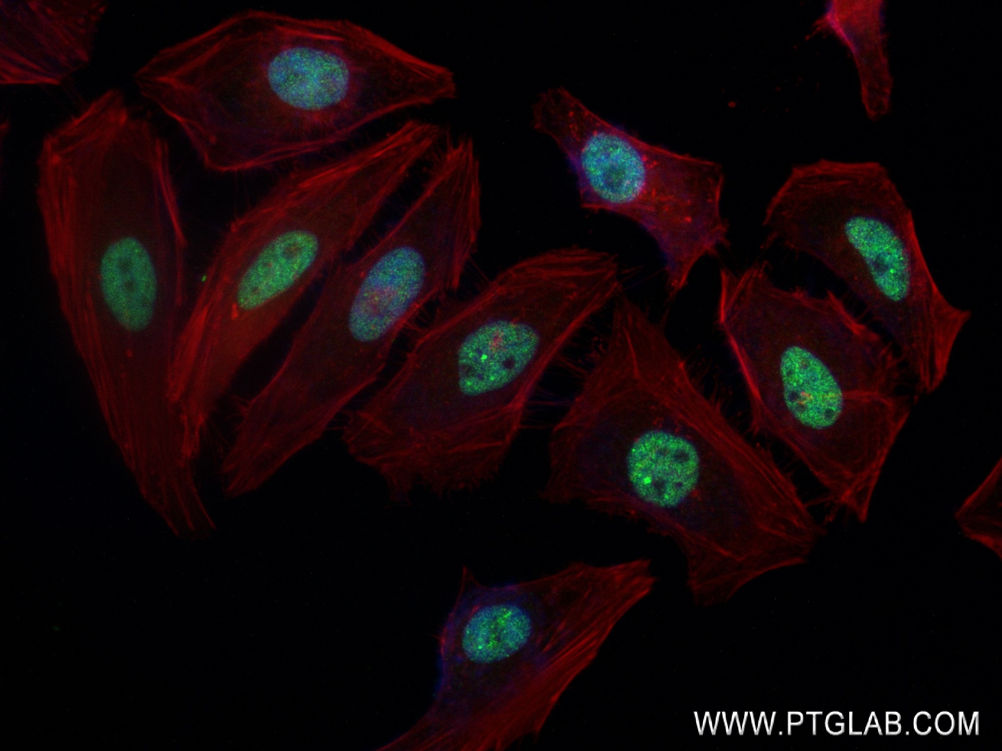 Immunofluorescence (IF) / fluorescent staining of HeLa cells using PURG Recombinant antibody (84399-3-RR)