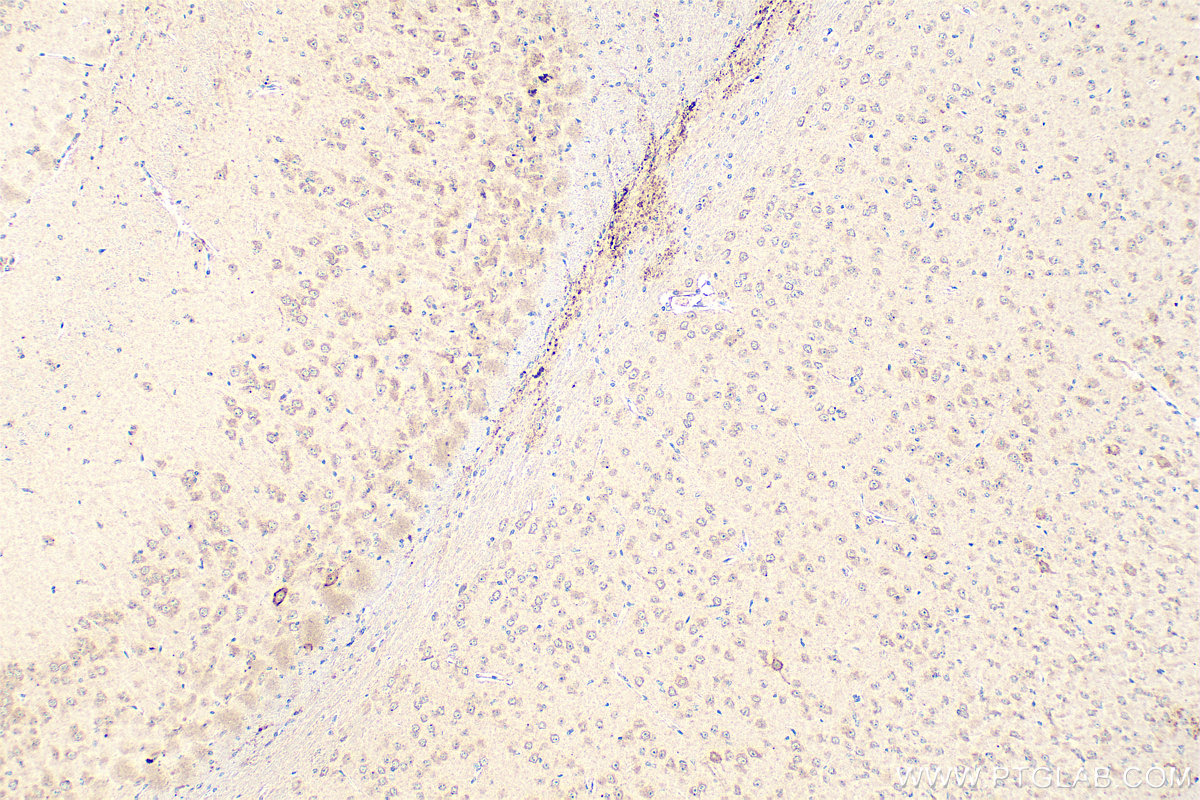 Immunohistochemistry (IHC) staining of mouse brain tissue using PXMP3 Polyclonal antibody (22163-1-AP)