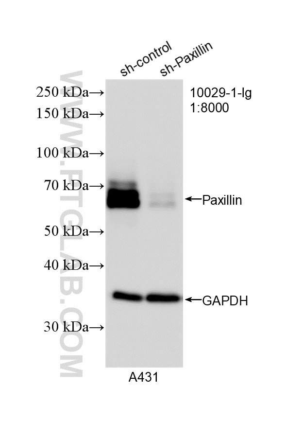 Western Blot (WB) analysis of A431 cells using Paxillin Polyclonal antibody (10029-1-Ig)