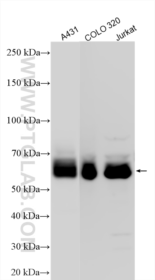 Western Blot (WB) analysis of various lysates using Paxillin Polyclonal antibody (10029-1-Ig)