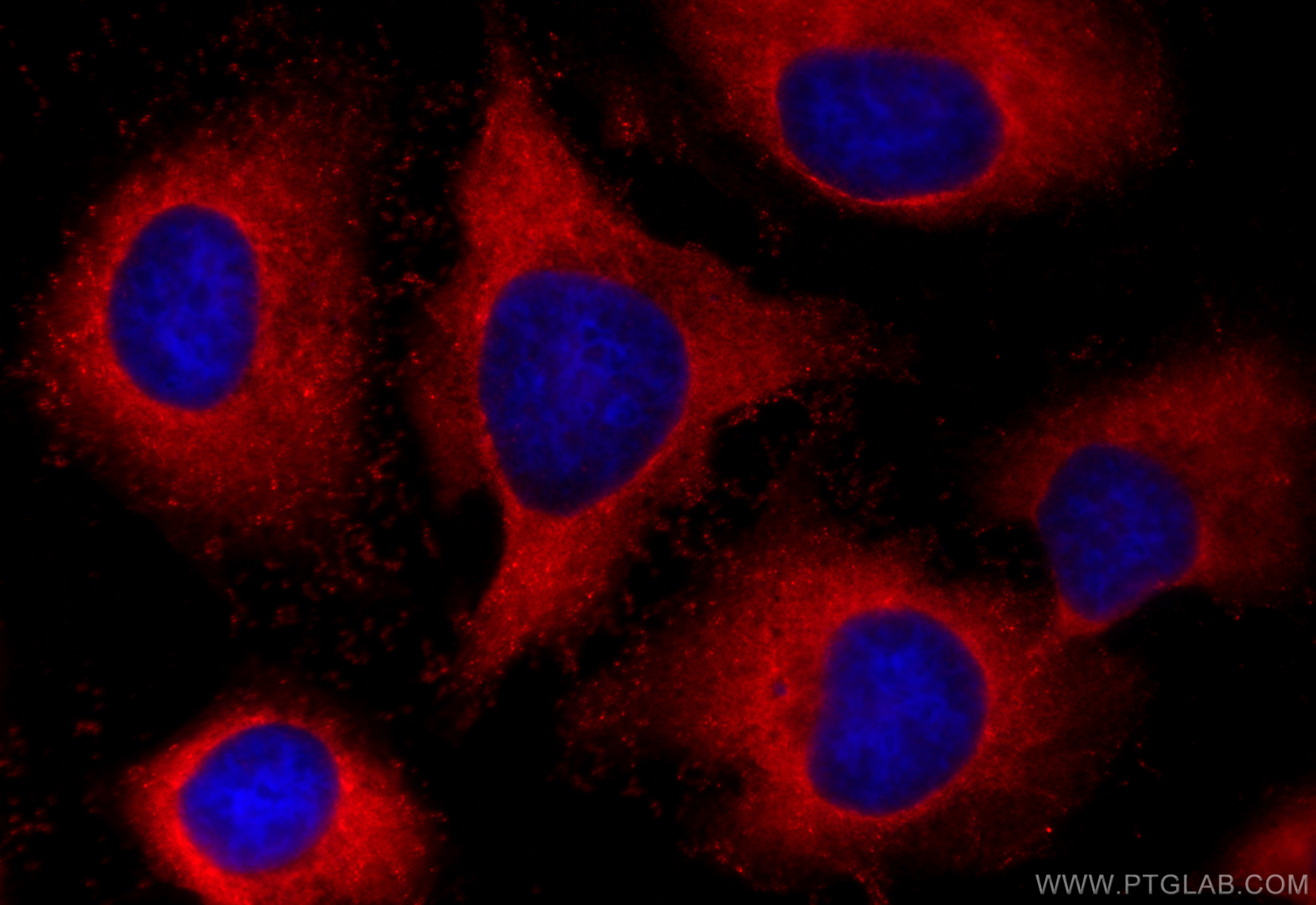 Immunofluorescence (IF) / fluorescent staining of HeLa cells using PYCR2-specific Polyclonal antibody (55060-1-AP)