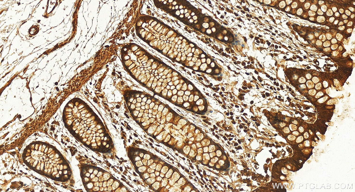 Immunohistochemistry (IHC) staining of human normal colon using PYGB Polyclonal antibody (12075-1-AP)