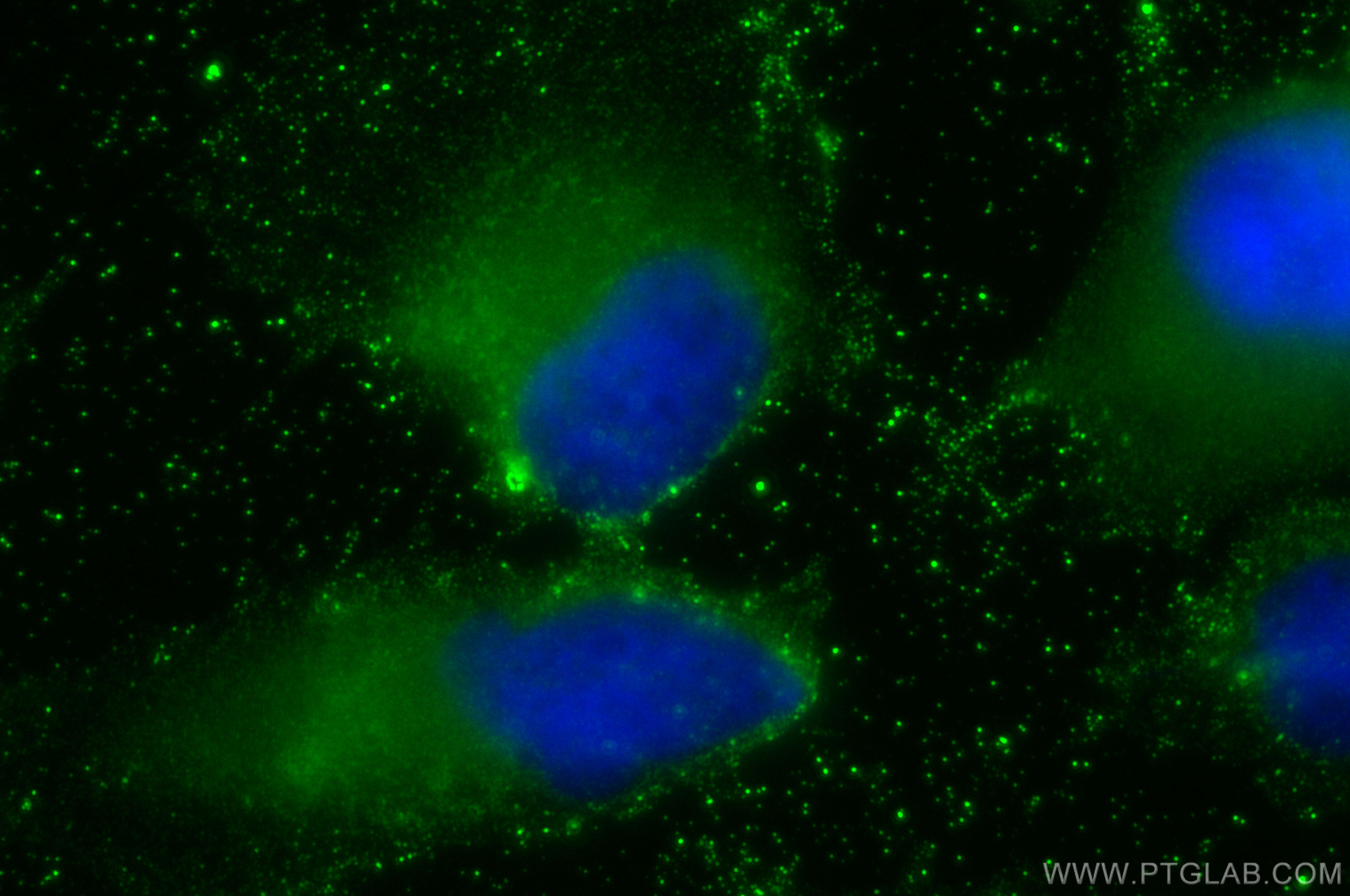 Immunofluorescence (IF) / fluorescent staining of U-251 cells using PYGL Monoclonal antibody (66769-1-Ig)