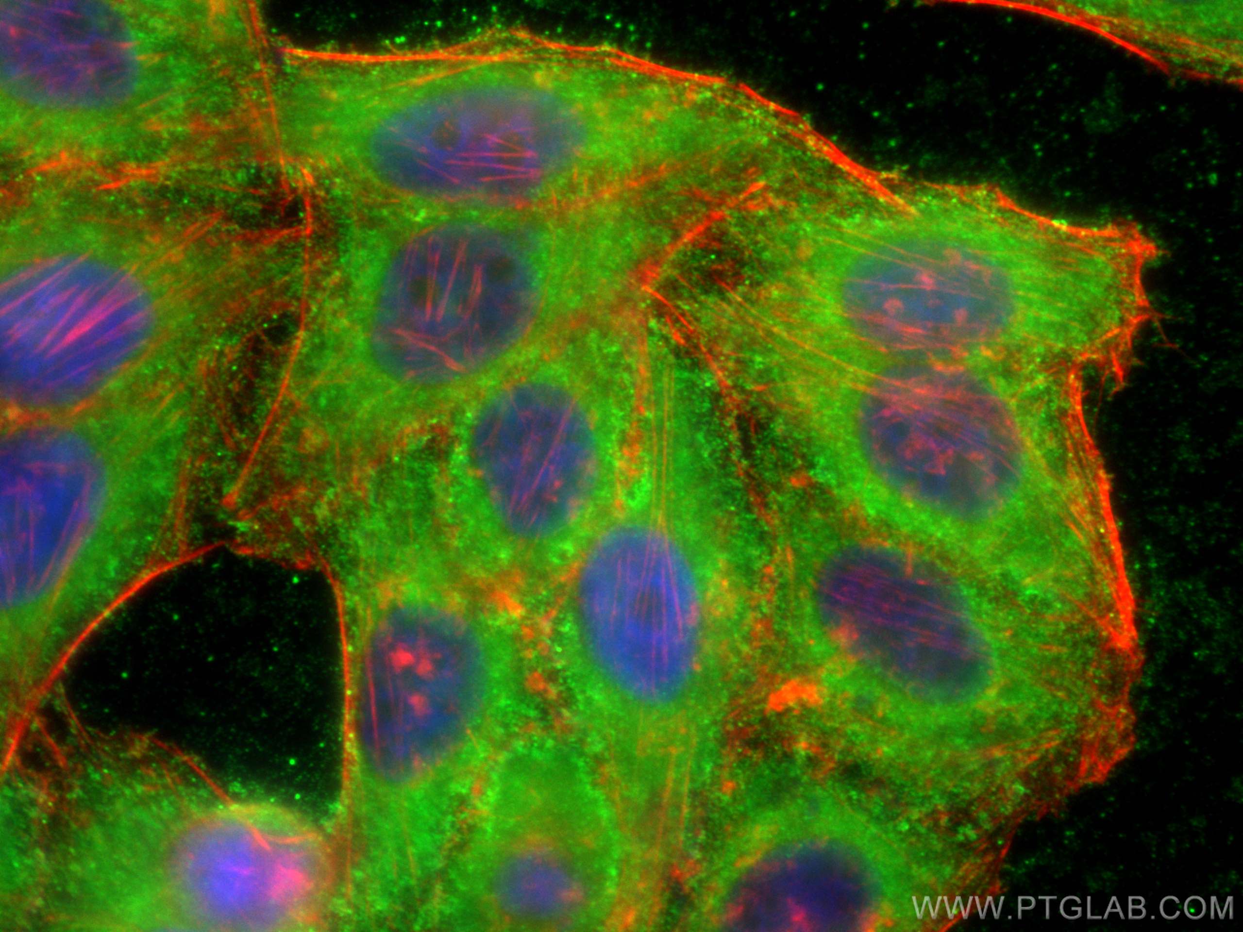 Immunofluorescence (IF) / fluorescent staining of HepG2 cells using PYGM-Specific Polyclonal antibody (19716-1-AP)