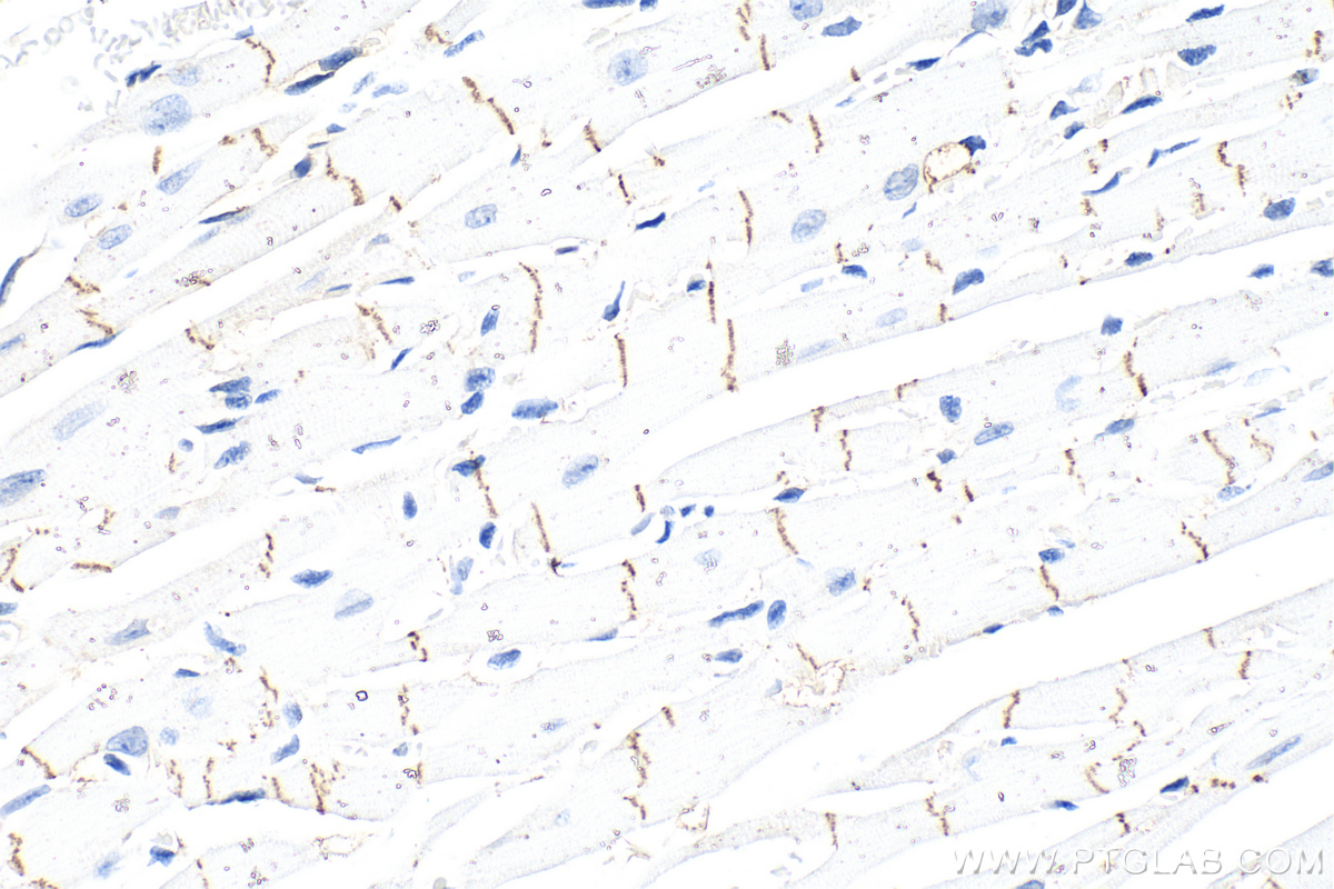 Immunohistochemistry (IHC) staining of mouse heart tissue using Pan-cadherin Polyclonal antibody (31313-1-AP)