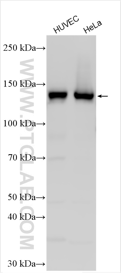 Western Blot (WB) analysis of various lysates using Pan-cadherin Polyclonal antibody (31313-1-AP)