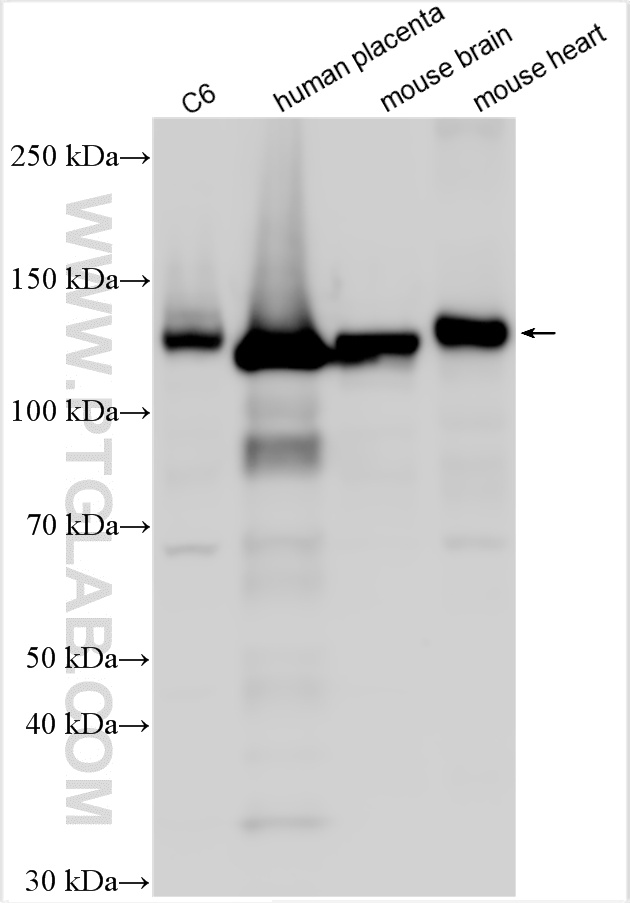 Western Blot (WB) analysis of various lysates using Pan-cadherin Polyclonal antibody (31313-1-AP)