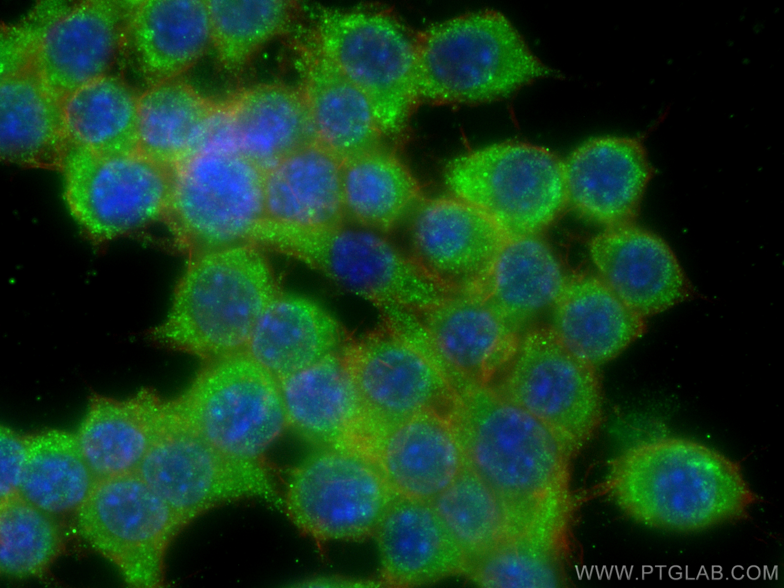 Immunofluorescence (IF) / fluorescent staining of RAW 264.7 cells using PARK2/Parkin Monoclonal antibody (66674-1-Ig)