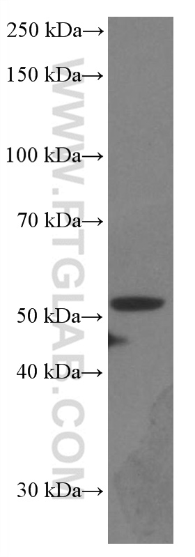 Western Blot (WB) analysis of U-251 cells using PARK2/Parkin Monoclonal antibody (66674-1-Ig)