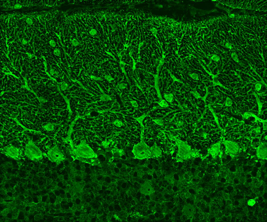 Immunofluorescence (IF) / fluorescent staining of mouse cerebellum tissue using Parvalbumin Polyclonal antibody (29312-1-AP)