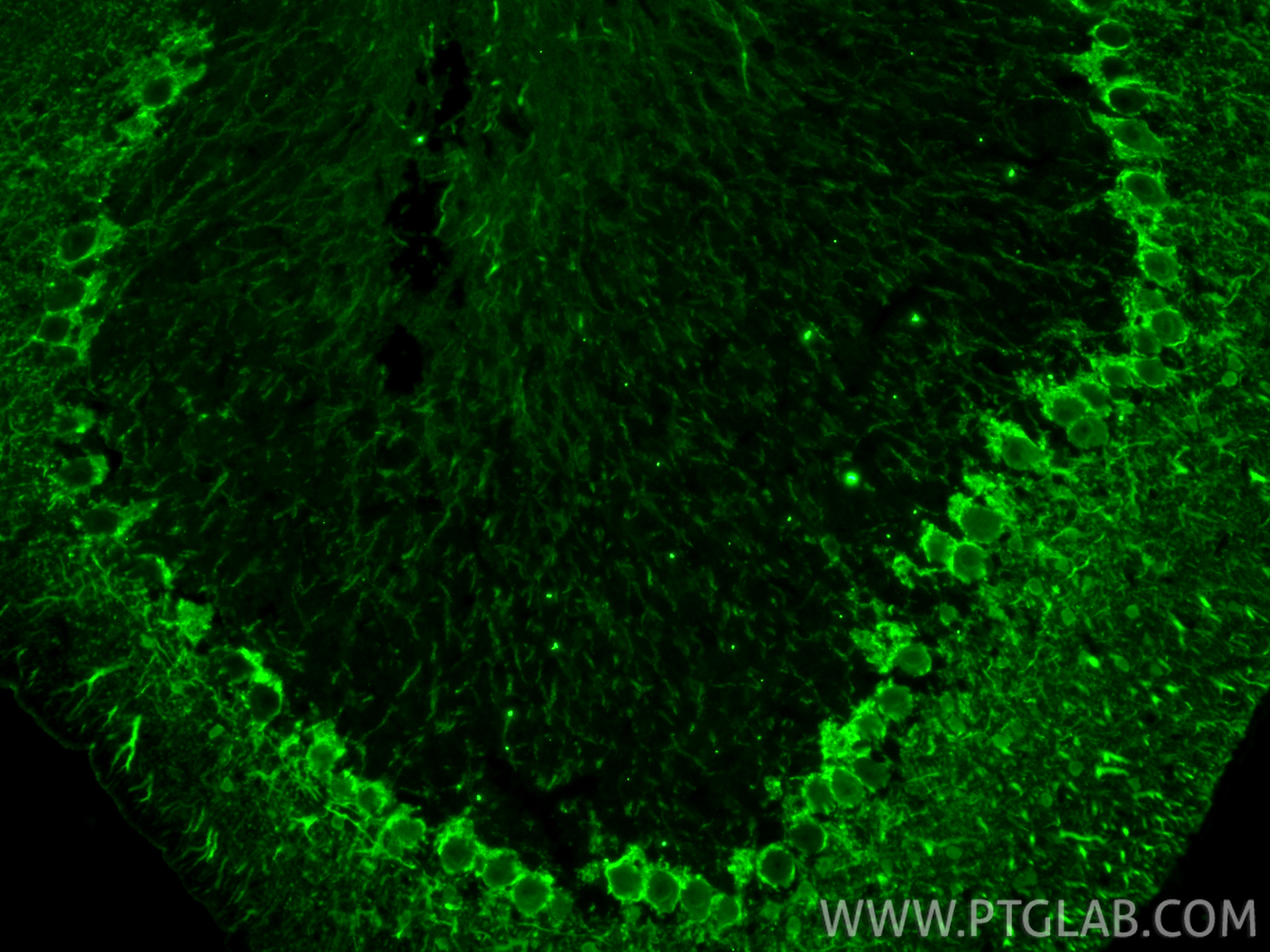 Immunofluorescence (IF) / fluorescent staining of mouse cerebellum tissue using Parvalbumin Polyclonal antibody (29312-1-AP)