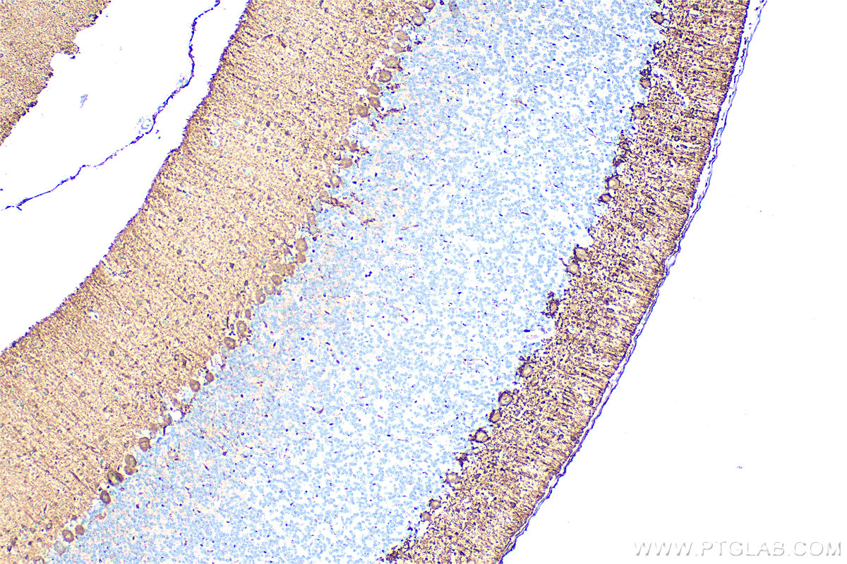 Immunohistochemistry (IHC) staining of rat cerebellum tissue using Parvalbumin Polyclonal antibody (29312-1-AP)