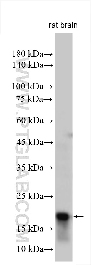 Western Blot (WB) analysis of various lysates using Parvalbumin Polyclonal antibody (29312-1-AP)