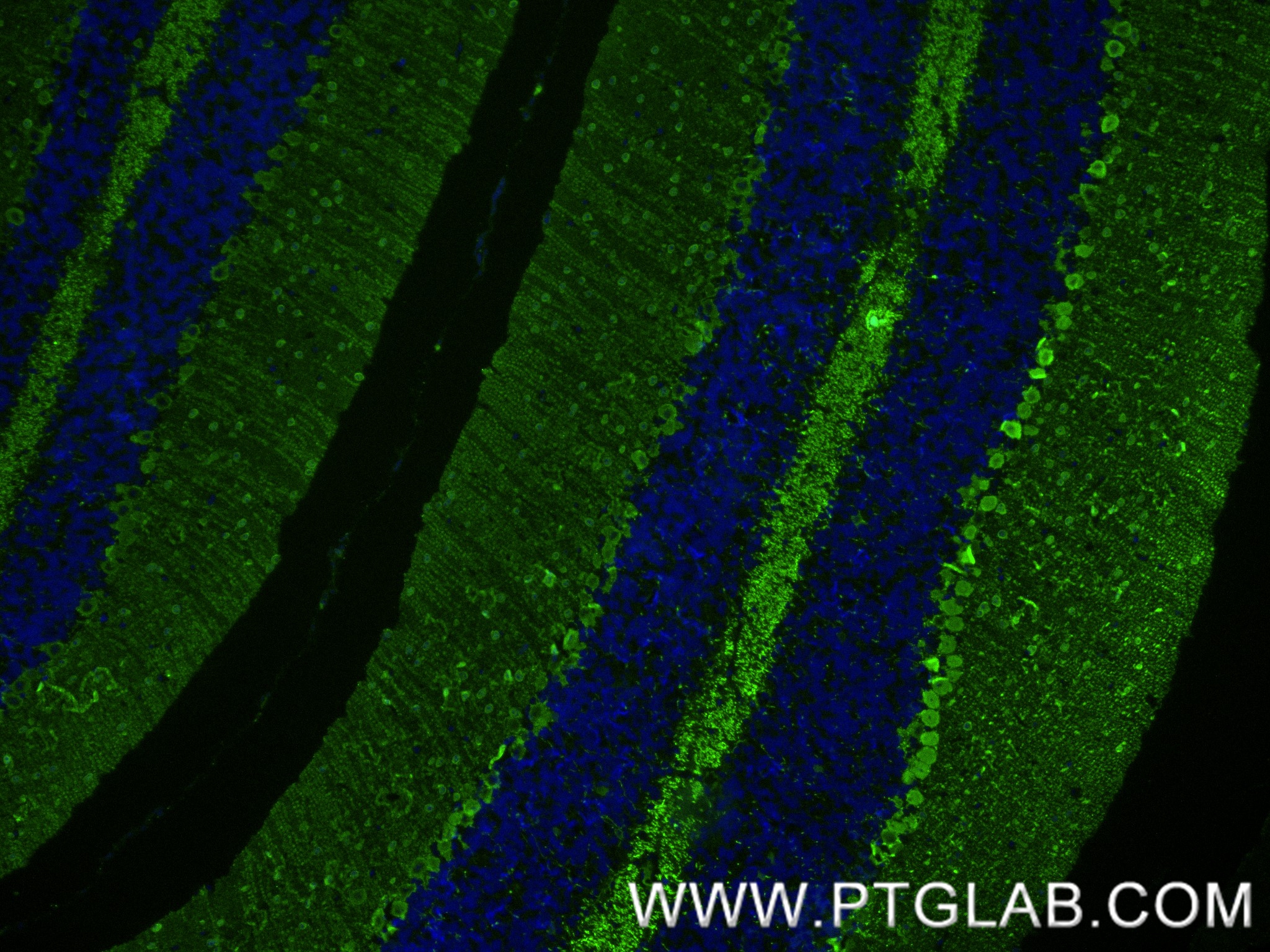 Immunofluorescence (IF) / fluorescent staining of mouse cerebellum tissue using Parvalbumin Recombinant antibody (85819-4-RR)