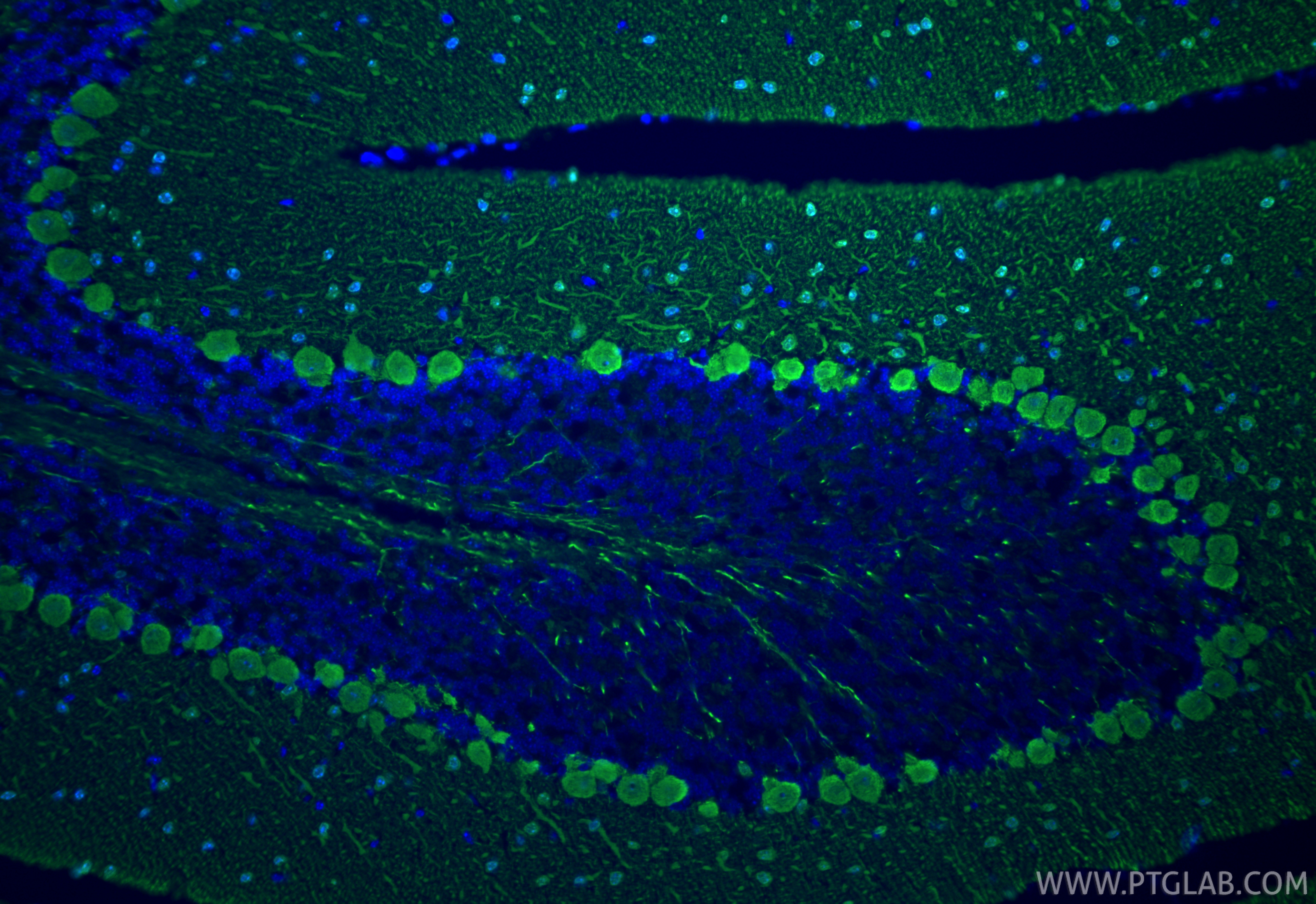 Immunofluorescence (IF) / fluorescent staining of mouse cerebellum tissue using Parvalbumin Recombinant monoclonal antibody (85819-4-RR)