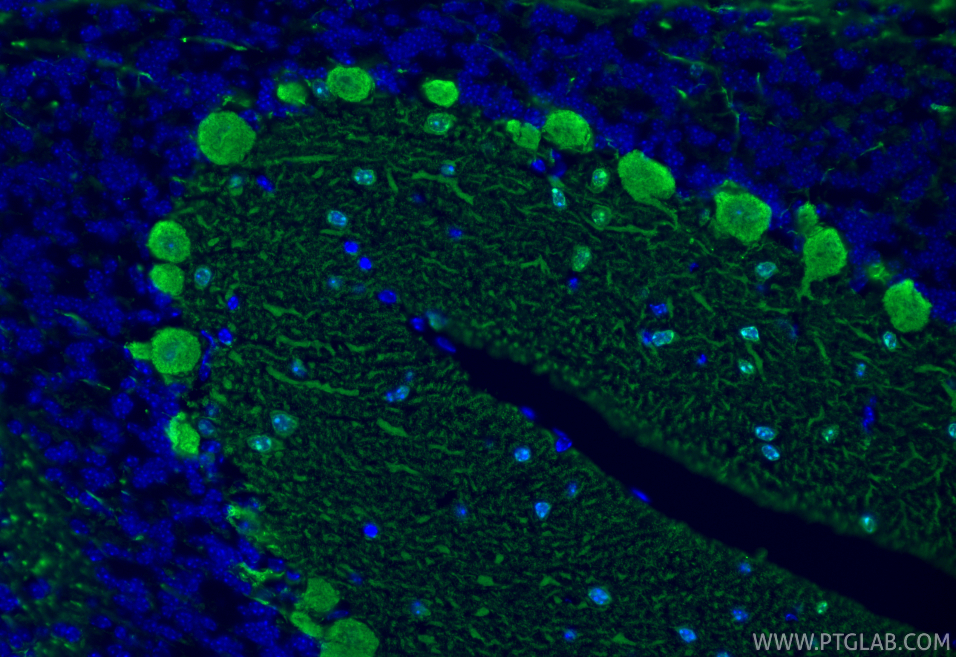 Immunofluorescence (IF) / fluorescent staining of mouse cerebellum tissue using Parvalbumin Recombinant monoclonal antibody (85819-4-RR)