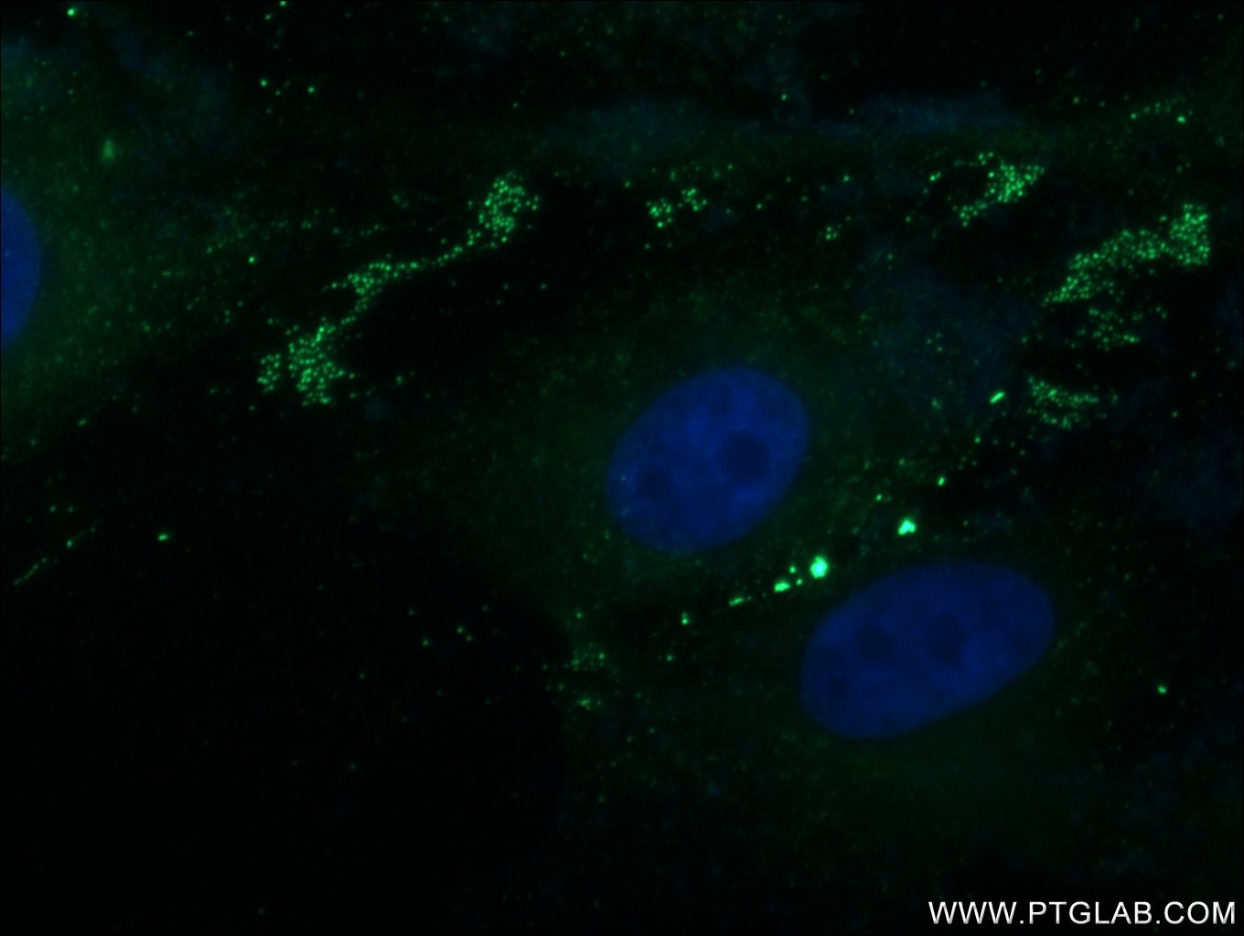 Immunofluorescence (IF) / fluorescent staining of MDCK cells using Paxillin Polyclonal antibody (22172-1-AP)