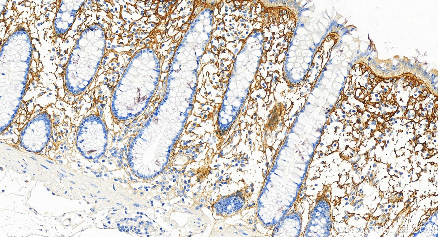 Immunohistochemistry (IHC) staining of human colon tissue using Periostin Monoclonal antibody (66491-1-Ig)