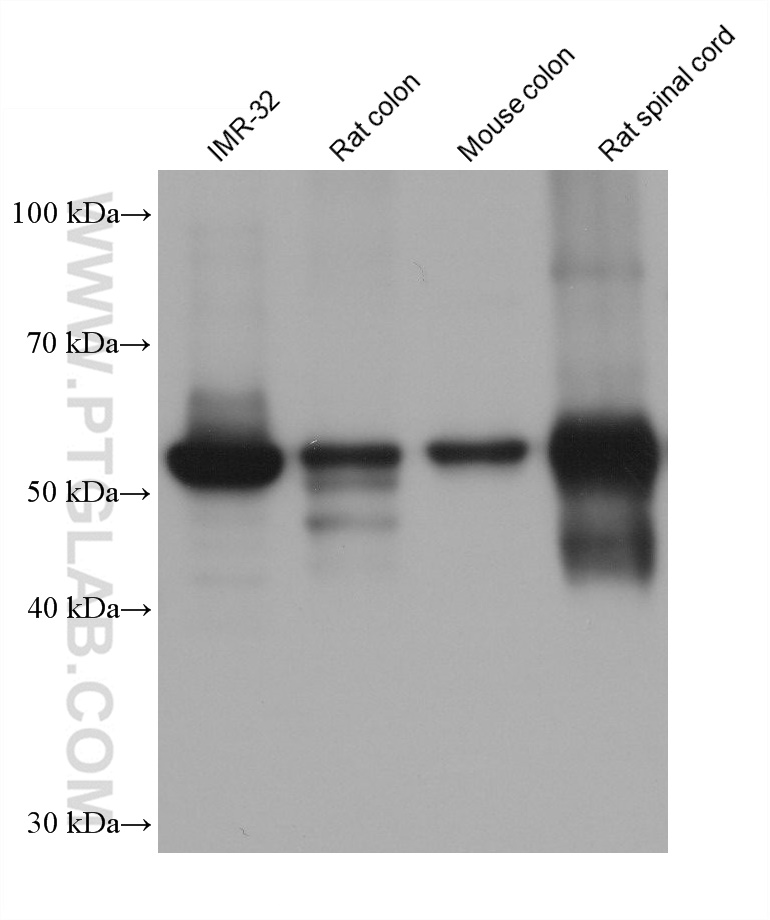 Western Blot (WB) analysis of various lysates using Peripherin Monoclonal antibody (66317-1-Ig)