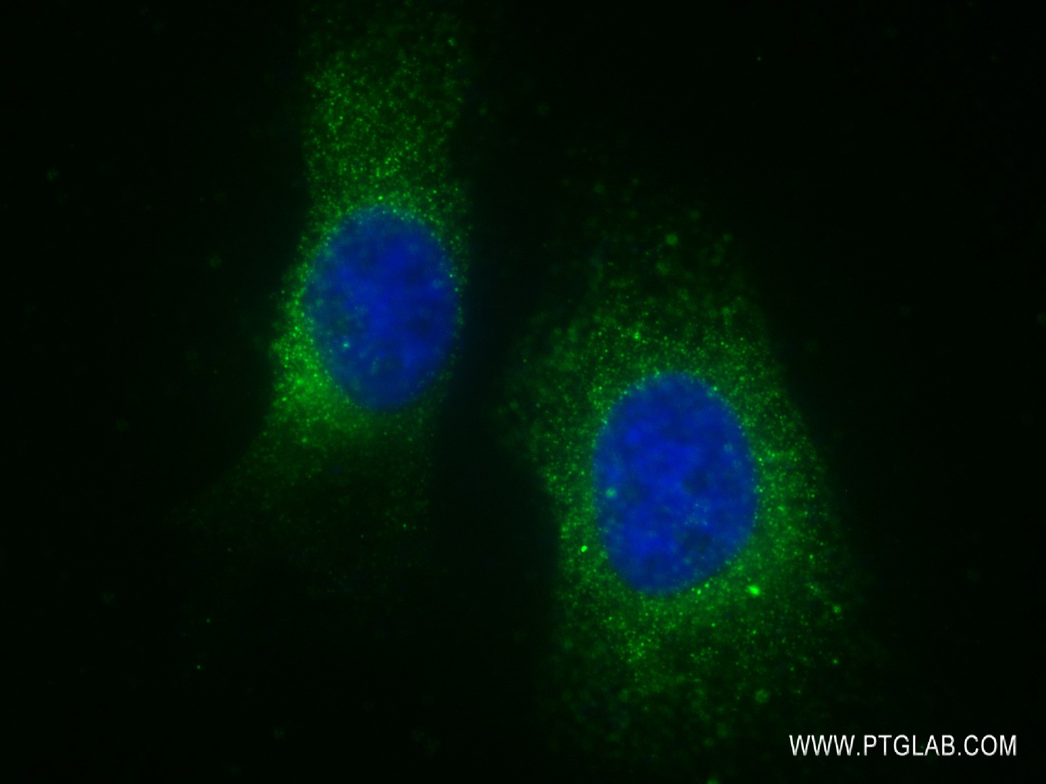 Immunofluorescence (IF) / fluorescent staining of HeLa cells using Phospho-ACC1 (Ser79) Recombinant antibody (80281-2-RR)