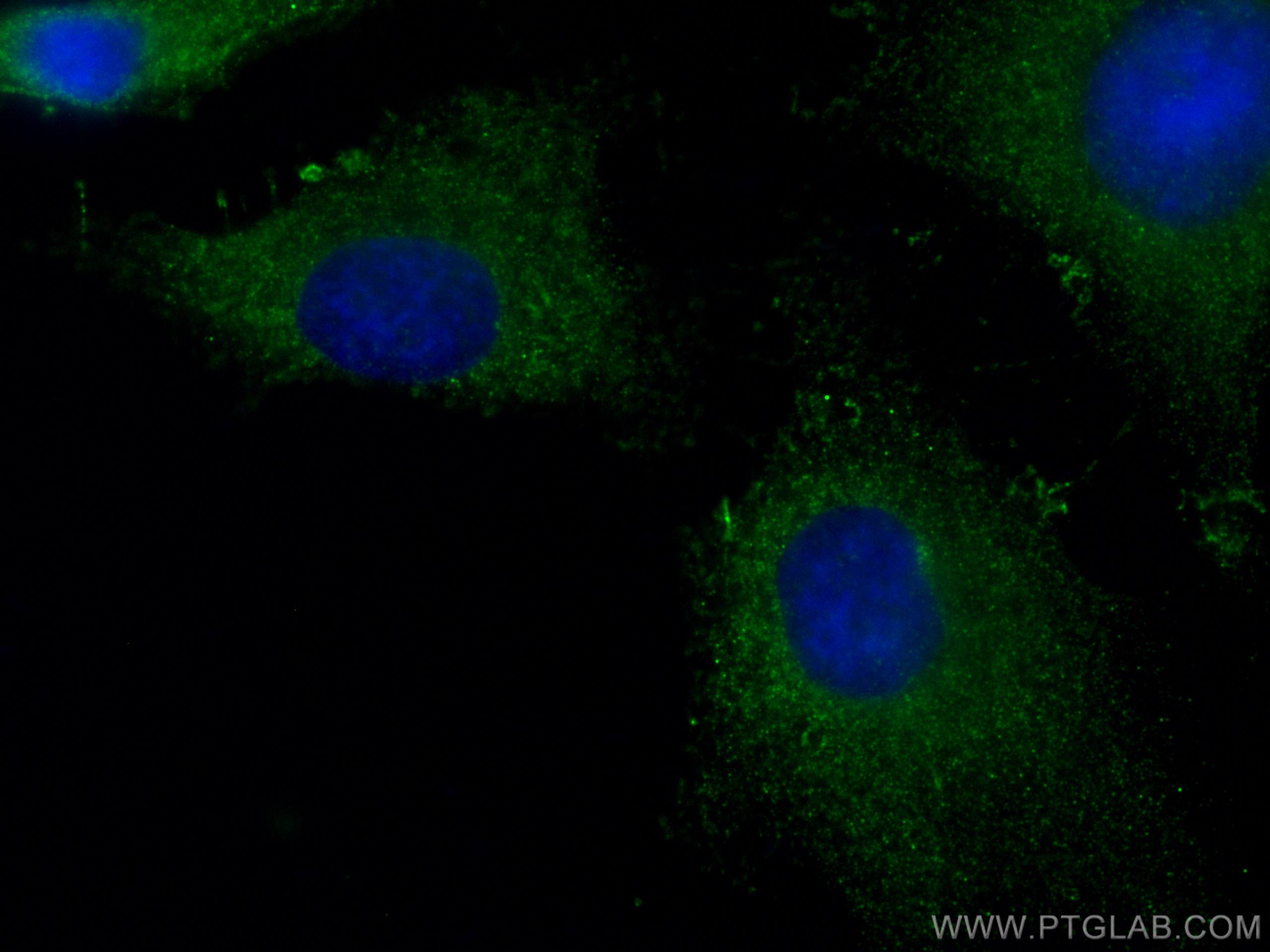 Immunofluorescence (IF) / fluorescent staining of HeLa cells using CoraLite® Plus 488-conjugated Phospho-AKT (Ser473) (CL488-66444)