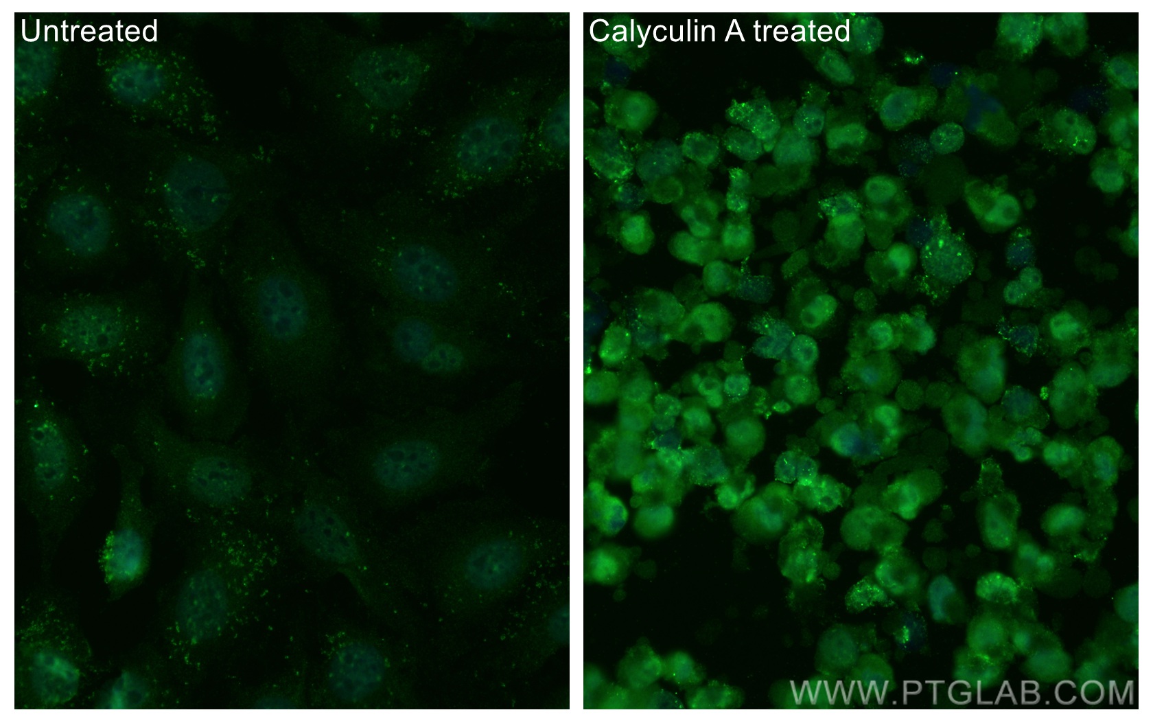 Immunofluorescence (IF) / fluorescent staining of HeLa cells using CoraLite® Plus 488-conjugated Phospho-AKT (Ser473) (CL488-66444)