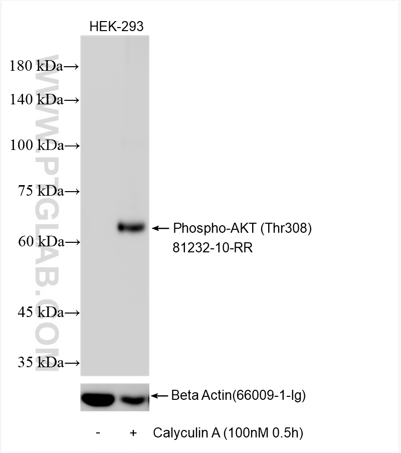 Western Blot (WB) analysis of various lysates using Phospho-AKT (Thr308) Recombinant antibody (81232-10-RR)