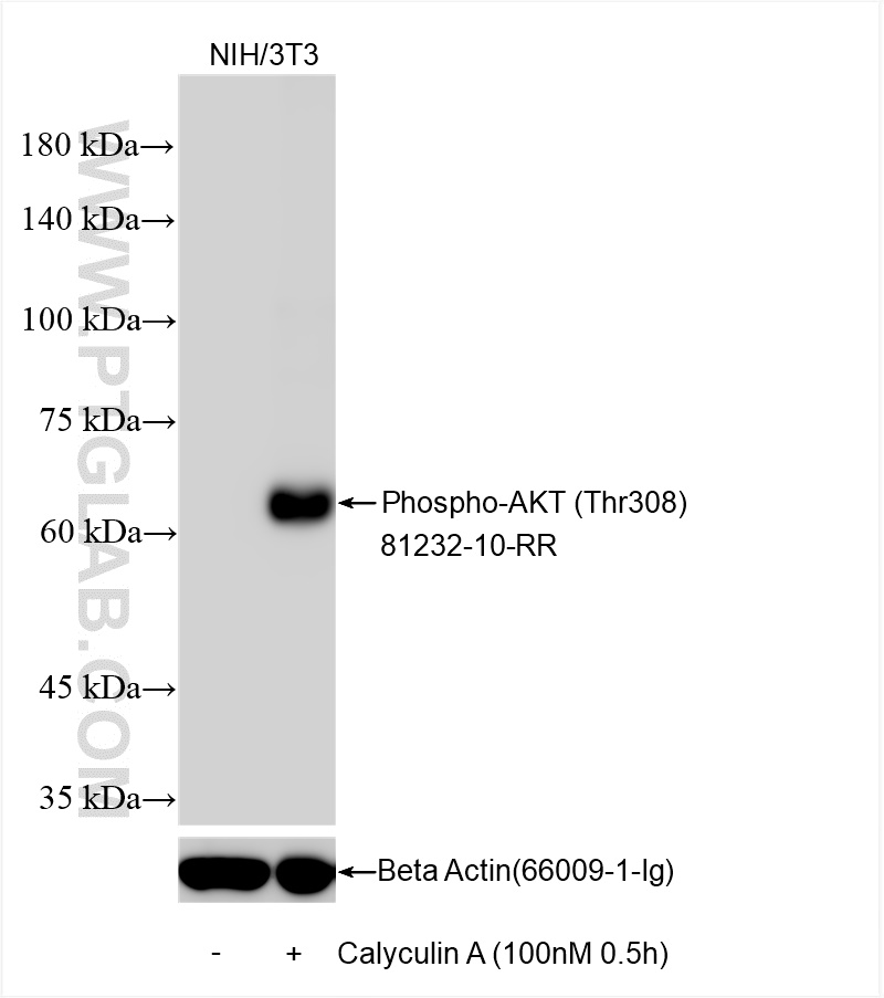 Western Blot (WB) analysis of various lysates using Phospho-AKT (Thr308) Recombinant antibody (81232-10-RR)