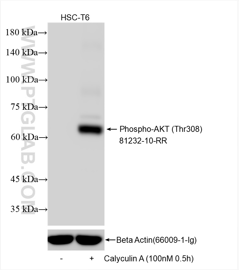 Western Blot (WB) analysis of various lysates using Phospho-AKT (Thr308) Recombinant antibody (81232-10-RR)