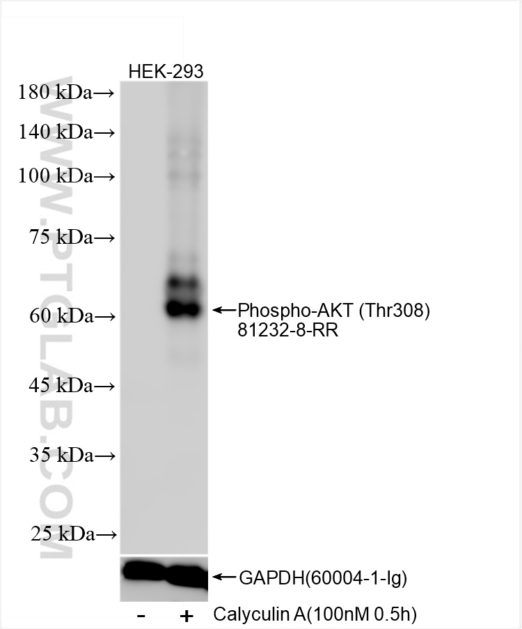 Western Blot (WB) analysis of various lysates using Phospho-AKT (Thr308) Recombinant antibody (81232-8-RR)