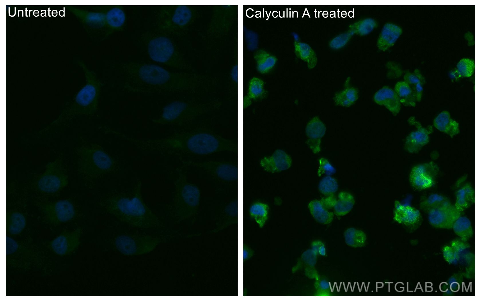 Immunofluorescence (IF) / fluorescent staining of HeLa cells using CoraLite® Plus 488-conjugated Phospho-AKT1 (Ser473 (CL488-80462)