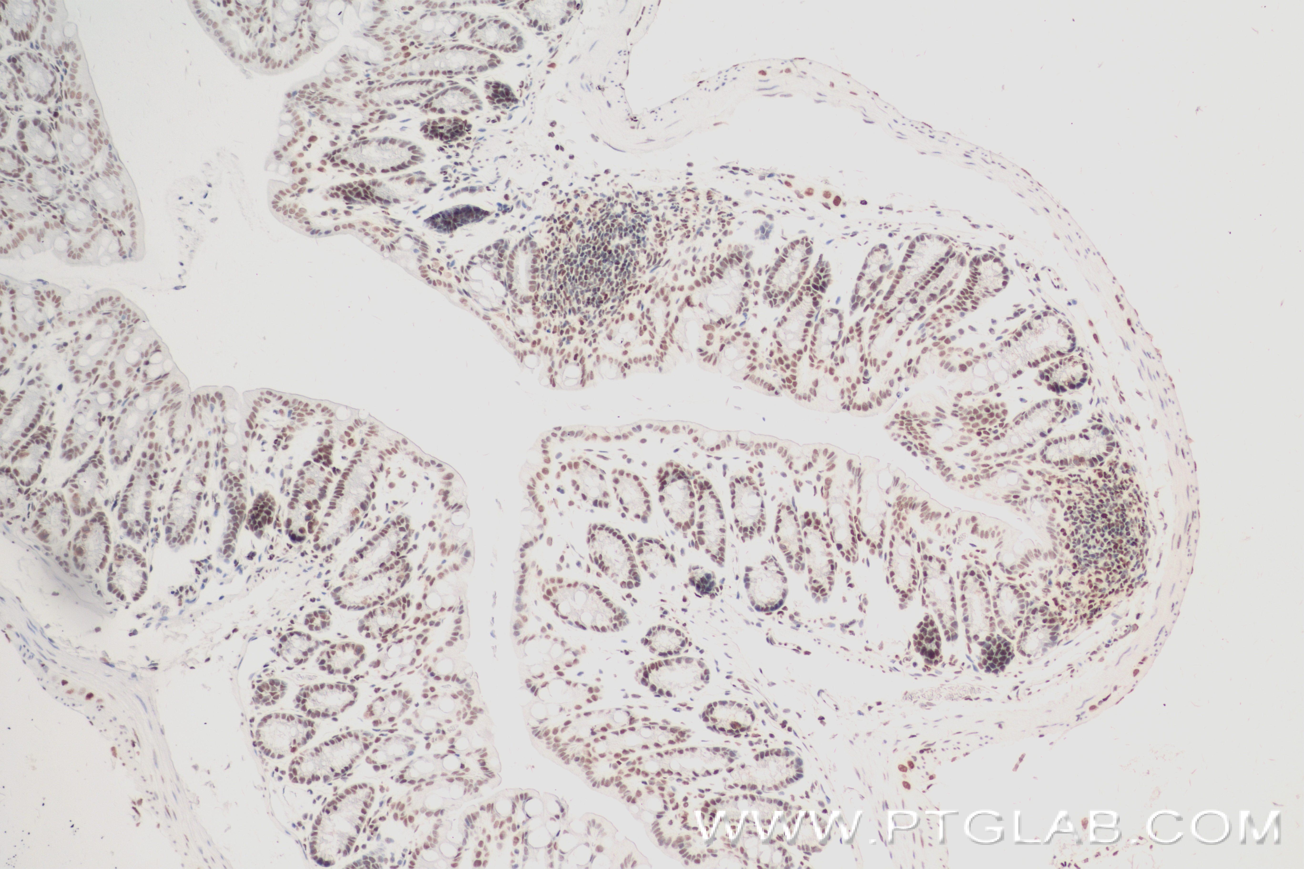 Immunohistochemistry (IHC) staining of mouse colon tissue using Phospho-CREB1 (Ser133) Recombinant antibody (81871-1-RR)