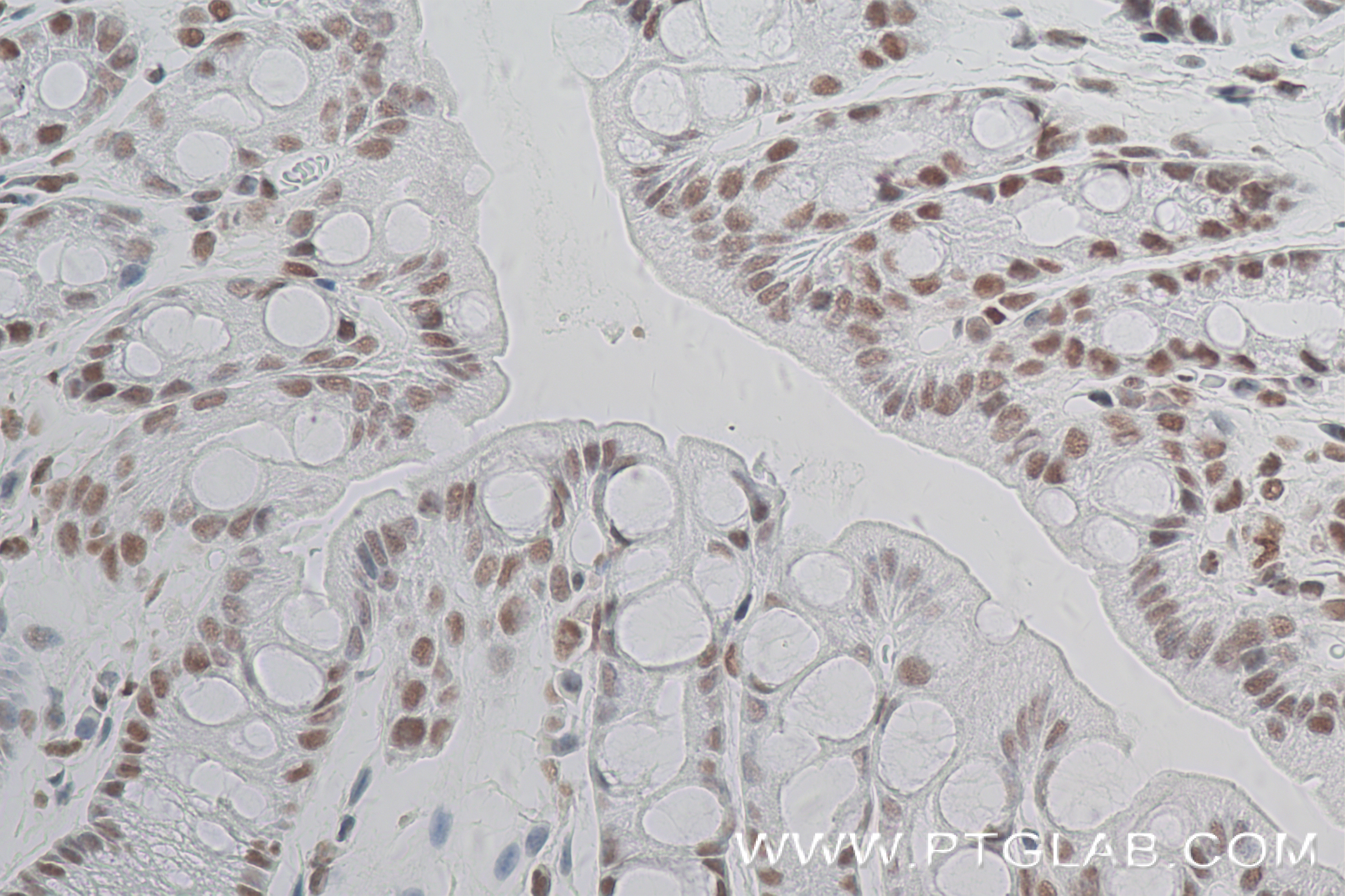 Immunohistochemistry (IHC) staining of mouse colon tissue using Phospho-CREB1 (Ser133) Recombinant antibody (81871-1-RR)