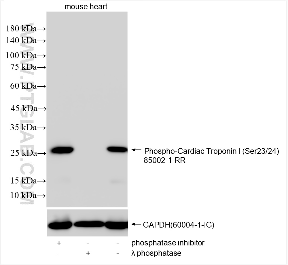 Western Blot (WB) analysis of various lysates using Phospho-Cardiac Troponin I (Ser23/24) Recombinant  (85002-1-RR)