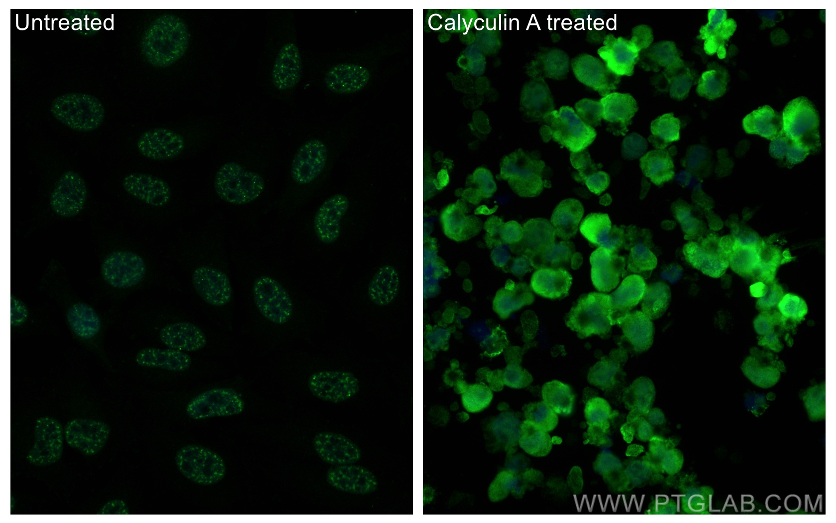 Immunofluorescence (IF) / fluorescent staining of HeLa cells using Phospho-Caspase 9 (Ser196) Recombinant antibody (80346-1-RR)