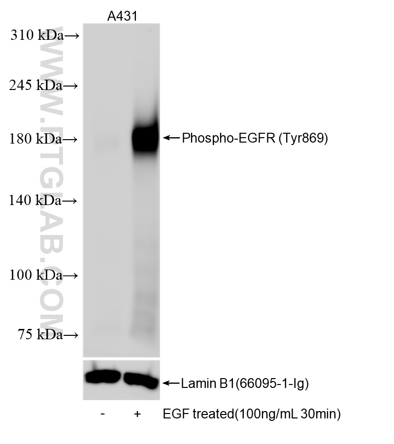 Western Blot (WB) analysis of various lysates using Phospho-EGFR (Tyr869) Recombinant antibody (84839-1-RR)