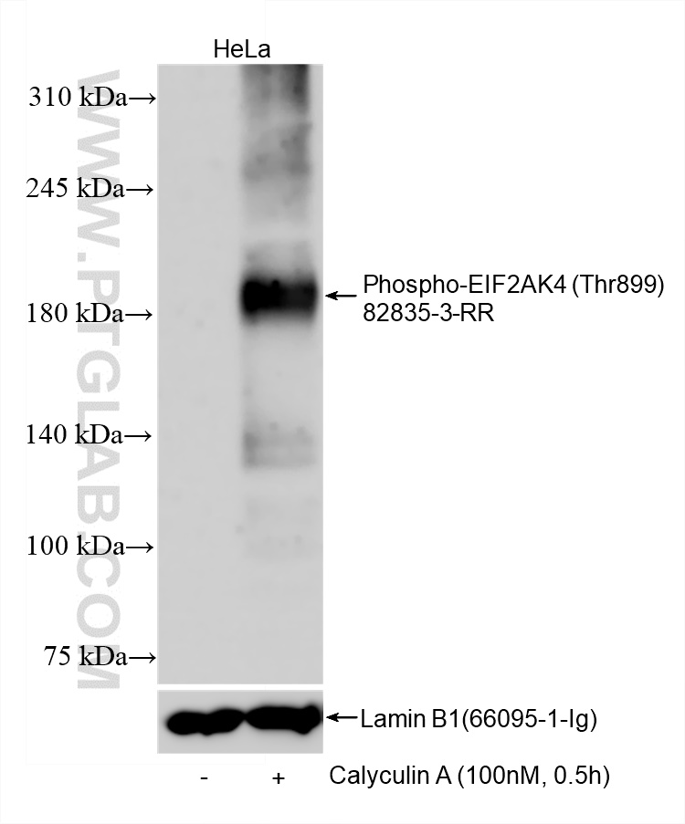 Western Blot (WB) analysis of various lysates using Phospho-EIF2AK4 (Thr899) Recombinant antibody (82835-3-RR)