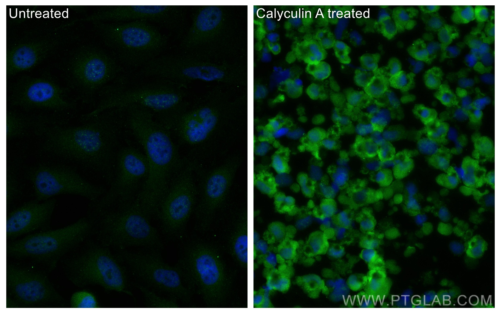 Immunofluorescence (IF) / fluorescent staining of HeLa cells using Phospho-EIF2S1 (Ser51) Monoclonal antibody (68023-1-Ig)