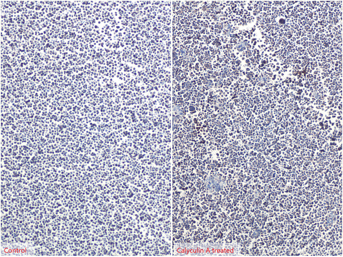 Immunohistochemistry (IHC) staining of Jurkat cells using Phospho-EIF4B (Ser406) Recombinant antibody (80059-1-RR)